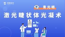 激光睫状体光凝术